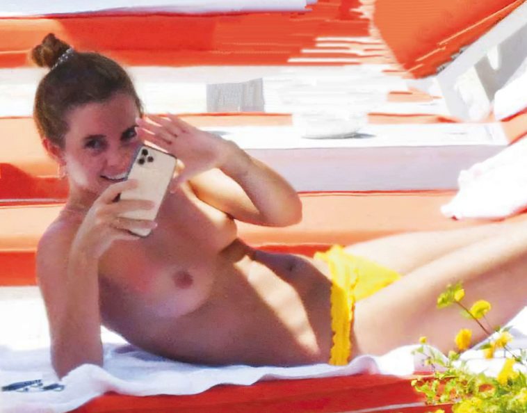 Emma Watson Nudes Topless Leaked Holiday Sunbathing Small Tits
